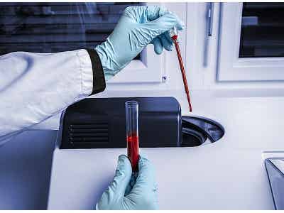 安東帕Anton Paar 顆粒粒度分析儀 PSA 1190圖2